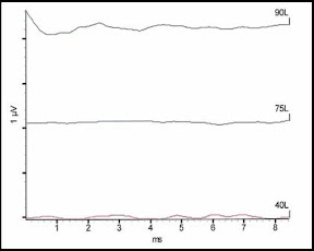 deaf_test_results
